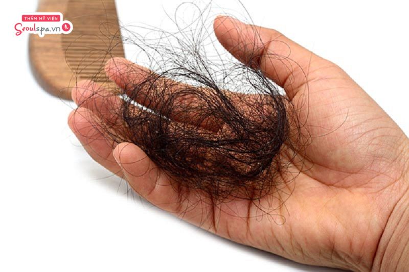 mo thay rung toc 1 Ngủ mơ thấy rụng tóc là điềm báo gì cho tương lai?